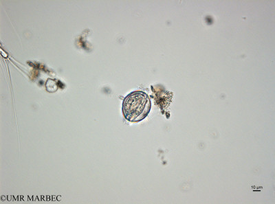 phyto/Thau_Lagoon/THAU_station1/OSU_plancton 2014/Protoperidinium cuspidatum (230614_proto_sp27200612_001_ovl-1).tif(copy)_thumb.jpg